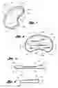 Fig. 02 - Surgically implantable knee prosthesis