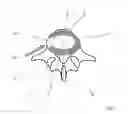 Fig. 02 - Method and a Device for Total Spinal Disc Replacement