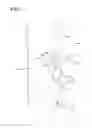 Fig. 08 - TIBIA IMPACTER