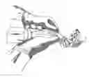 Fig. 01 - Means for Fixing Prostheses, Method of Inserting a Prosthesis Into a Grain Bed and a Prosthesis Insertion Unit