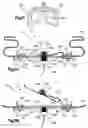 Fig. 08 - Air bag module with actuatable vent part