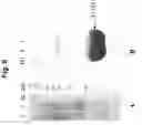 Fig. 09 - Suppression of gene expression for improved solar conversion efficiency and photosynthetic productivity in plants and algae
