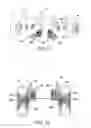 Fig. 07 - INTEGRATED HYDROSTATIC TRANSMISSION FOR LEFT AND RIGHT WHEEL DRIVE