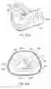 Fig. 35 - Ergonomic and adjustable respiratory mask assembly with headgear assembly