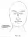 Fig. 44 - Ergonomic and adjustable respiratory mask assembly with headgear assembly