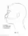 Fig. 45 - Ergonomic and adjustable respiratory mask assembly with headgear assembly