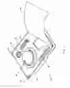 Fig. 02 - Percutaneous gastrointestinal anchoring kit