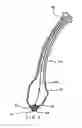 Fig. 05 - Percutaneous gastrointestinal anchoring kit