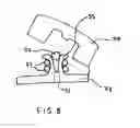 Fig. 08 - Percutaneous gastrointestinal anchoring kit