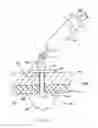 Fig. 09 - Percutaneous gastrointestinal anchoring kit