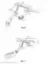 Fig. 06 - Cable clip for organizing and routing cables and wires