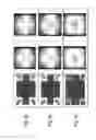 Fig. 06 - System and method for optically imaging objects on a detection device by a pinhole aperture