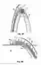 Fig. 04 - Double padded finger seal