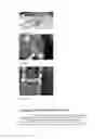 Fig. 22 - System and method for providing a low and narrow-profile radio frequency identification (RFID) tag