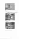 Fig. 33 - System and method for providing a low and narrow-profile radio frequency identification (RFID) tag