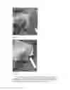 Fig. 40 - System and method for providing a low and narrow-profile radio frequency identification (RFID) tag