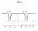 Fig. 07 - DISPLAY DEVICE