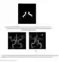 Fig. 06 - Vasculature partitioning methods and apparatus