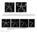 Fig. 07 - Vasculature partitioning methods and apparatus