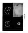 Fig. 10 - METHOD AND SYSTEM FOR PROVIDING ACCURACY EVALUATION OF IMAGE GUIDED SURGERY