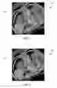 Fig. 05 - Purpose-driven enhancement filtering of anatomical data