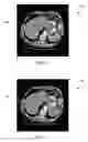 Fig. 06 - Purpose-driven enhancement filtering of anatomical data