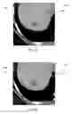 Fig. 07 - Purpose-driven enhancement filtering of anatomical data