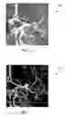 Fig. 08 - Purpose-driven enhancement filtering of anatomical data
