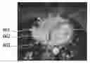 Fig. 01 - Volume of interest selection