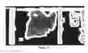 Fig. 05 - System and method for finding regions of interest for microscopic digital montage imaging