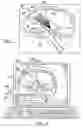 Fig. 06 - Method for identification of anatomical landmarks