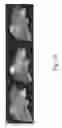 Fig. 20 - Apparatus and methods of compensating for organ deformation, registration of internal structures to images, and applications of same