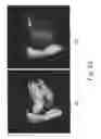 Fig. 30 - Apparatus and methods of compensating for organ deformation, registration of internal structures to images, and applications of same