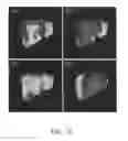 Fig. 33 - Apparatus and methods of compensating for organ deformation, registration of internal structures to images, and applications of same