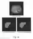 Fig. 35 - Apparatus and methods of compensating for organ deformation, registration of internal structures to images, and applications of same