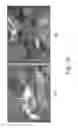 Fig. 37 - Apparatus and methods of compensating for organ deformation, registration of internal structures to images, and applications of same