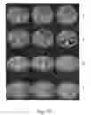 Fig. 40 - Apparatus and methods of compensating for organ deformation, registration of internal structures to images, and applications of same