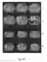 Fig. 41 - Apparatus and methods of compensating for organ deformation, registration of internal structures to images, and applications of same