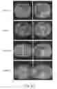 Fig. 43 - Apparatus and methods of compensating for organ deformation, registration of internal structures to images, and applications of same