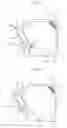 Fig. 17 - Bag-like container with spout