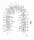 Fig. 02 - Spacer