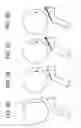 Fig. 05 - Toner drop suppressing developing apparatus