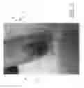 Fig. 09 - Algae supplement and treatment method