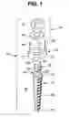 Fig. 02 - Dental implant