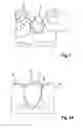 Fig. 02 - Method of Adapting a Dental Prosthetic Item Existing as a 3D Data Set