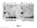 Fig. 02 - Antibodies That Specifically Bind PMS2