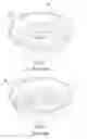 Fig. 02 - Inflating toy