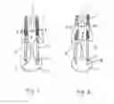 Fig. 02 - Apparatus for exercising deep abdominal and back muscles
