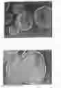 Fig. 06 - Polymer-based sustained release device