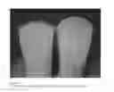 Fig. 02 - SILICONE STABILIZERS FOR FLAME-RETARDED RIGID POLYURETHANE OR POLYISOCYANURATE FOAMS